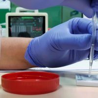 Importance of Drug Screening Test