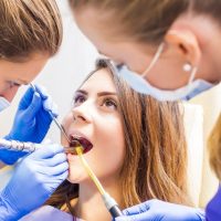 Dental Fillings