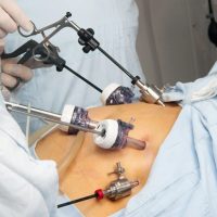 Gastrointestinal Surgery